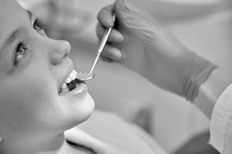 How long do dental sealants last